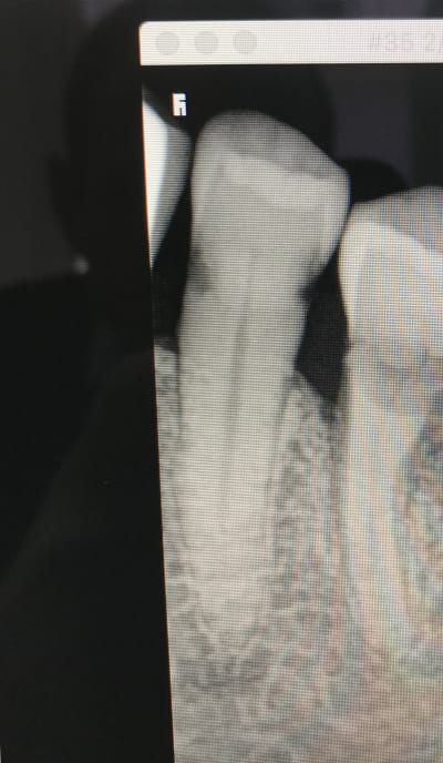 U8ovekqgoksn9ttykv7e - Eugenol