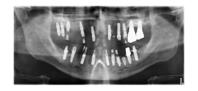 Umghmds18m1yg46cowdy0x93cczw - Eugenol