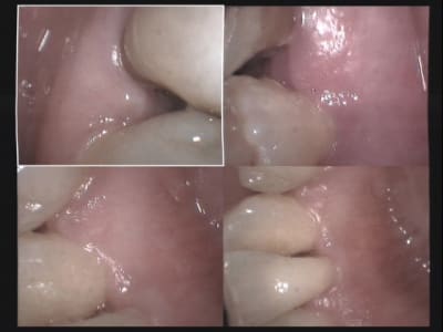 Un cas difficile paro à 10 jours 1 hxanrw - Eugenol