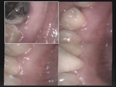 Un cas difficile paro à 30 jours 1 w2wrnj - Eugenol