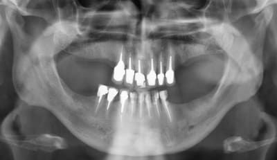 Ustvq9smmjbhixmku7tq - Eugenol