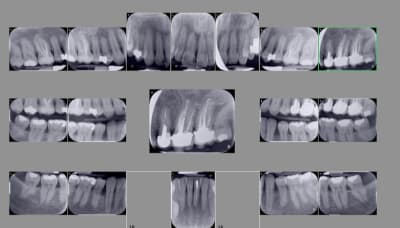 V850km9ag2lcyaevcovc - Eugenol