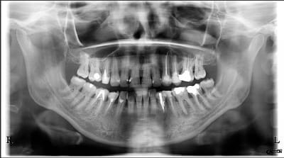 Ve4iksrvtna9dknrr281 - Eugenol
