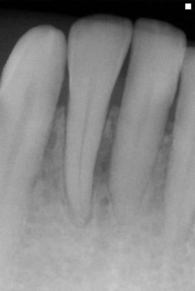 Verc déc06 imajsp - Eugenol