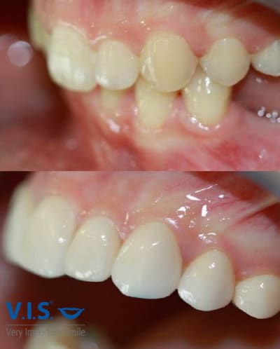 Vis89 web2 eerpuj - Eugenol