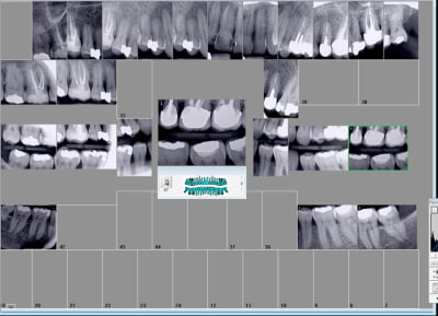 Vn43qbj0ifvgz43u3eev - Eugenol