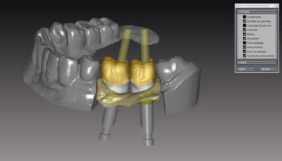 Vue v apr s r duction lzpmal - Eugenol