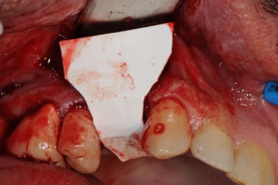 Wmgrynxcjbdnja8z0a8d - Eugenol