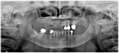 Wqlohplr4awurga78lyd - Eugenol