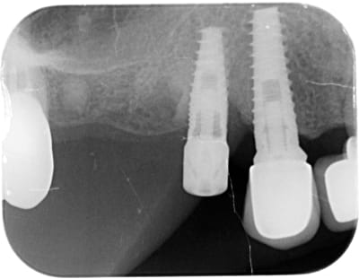 Wxqsj2uuc5fkmnsiwrosa1g9hk80 - Eugenol