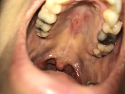 X7hz0firowlvuhxcdxkn - Eugenol