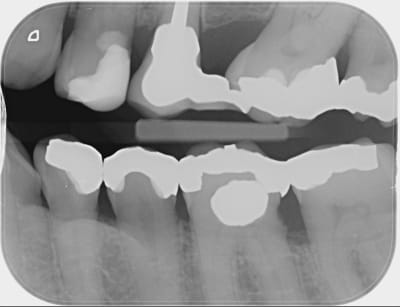 Xefrlsn2i5wgpiwfoctg - Eugenol