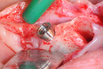 Xrbcpt7uwc9b3uj6slsu - Eugenol