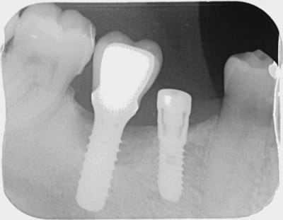 Xujlpqrdjpc3wy5wj1v8 - Eugenol