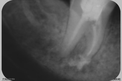 Yamen1 a3cuo0 - Eugenol