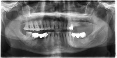 Zaigouche said 1 x1flv2 - Eugenol