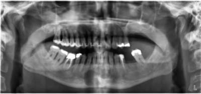 Zarbi d4cm9s - Eugenol