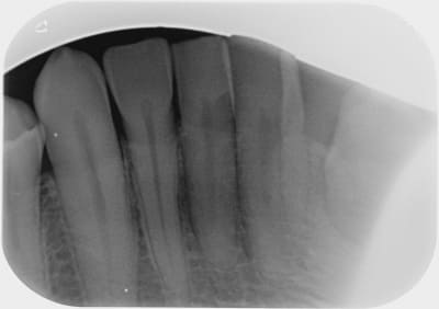 Zhl5c7ulzyl9ry6tniaa - Eugenol