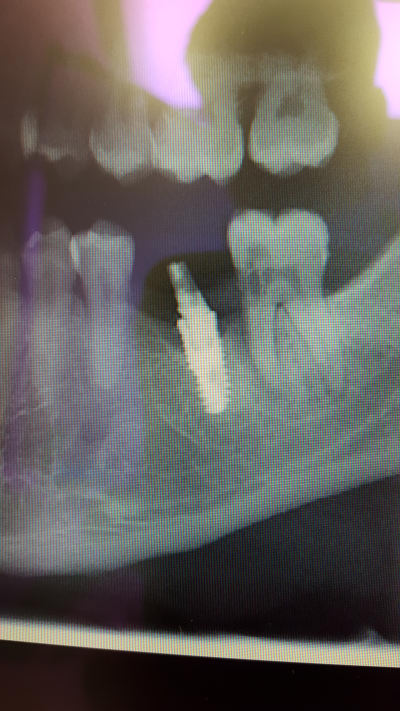 Zwlk8lamotspskqcopjs - Eugenol