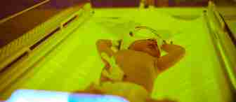 A newborn baby lies in an incubator under bright blue and yellow lights. The baby is wearing a small white eye mask and has medical tape and wires on its body, indicating it is receiving phototherapy treatment. The infant's arms are slightly raised.