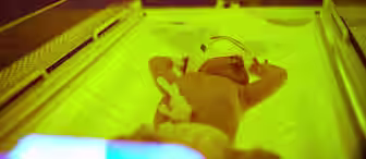 A newborn baby lies in an incubator under bright blue and yellow lights. The baby is wearing a small white eye mask and has medical tape and wires on its body, indicating it is receiving phototherapy treatment. The infant's arms are slightly raised.