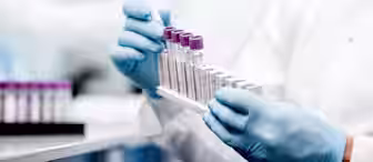 A person wearing blue gloves holds multiple test tubes with purple caps in a laboratory setting. Another blurred person in a lab coat can be seen in the background, engaging in lab work.