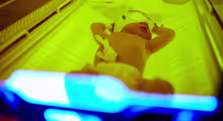A newborn baby lies in an incubator under bright blue and yellow lights. The baby is wearing a small white eye mask and has medical tape and wires on its body, indicating it is receiving phototherapy treatment. The infant's arms are slightly raised.