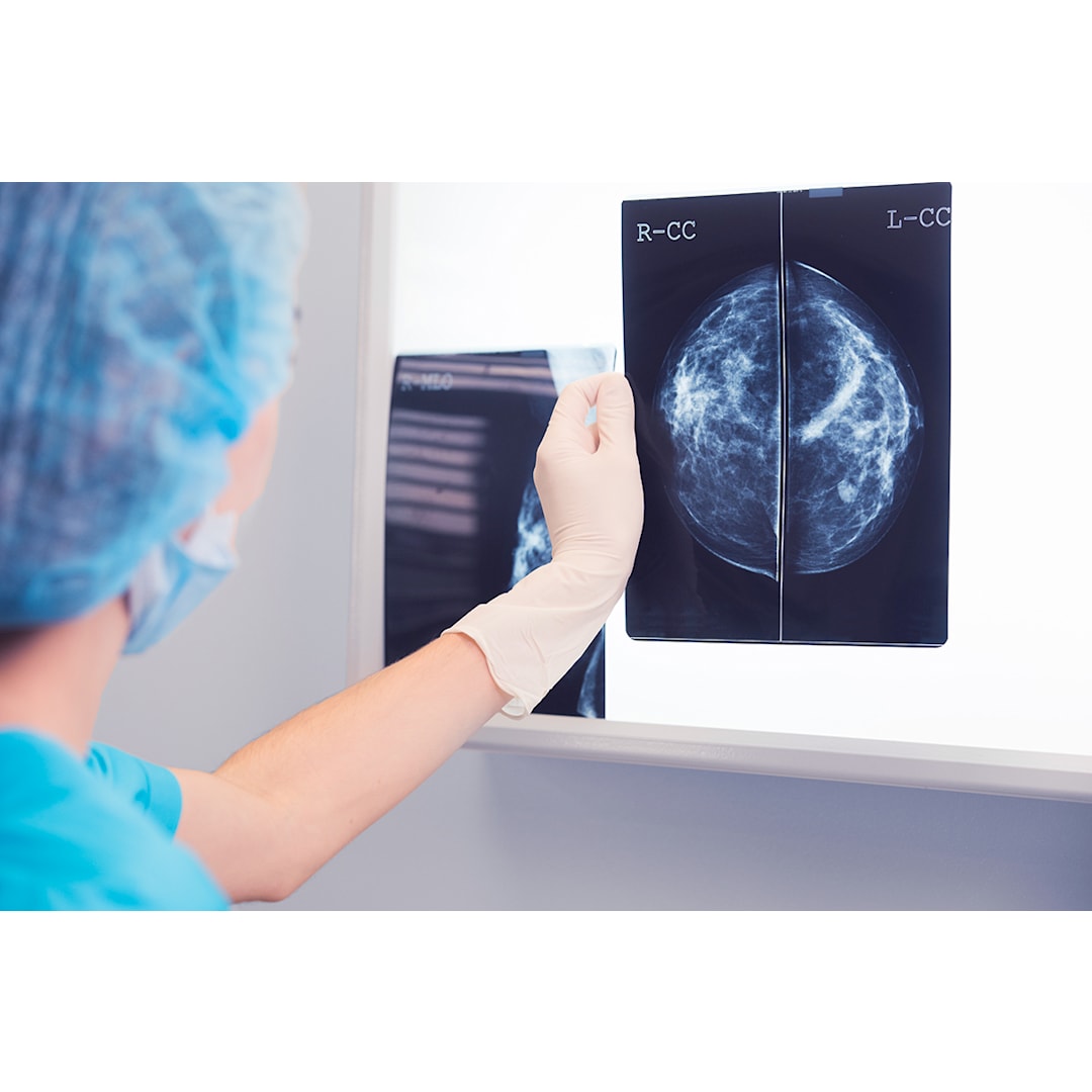 Woman faces reduced life expectancy following breast cancer failings at Queen  Alexandra Hospital | Fieldfisher
