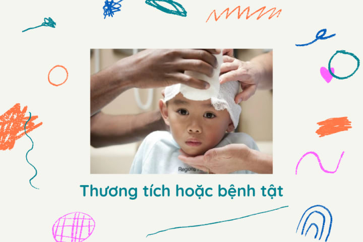 NHẬN BIẾT BIỂU HIỆN TRẺ CHẬM PHÁT TRIỂN TRÍ TUỆ