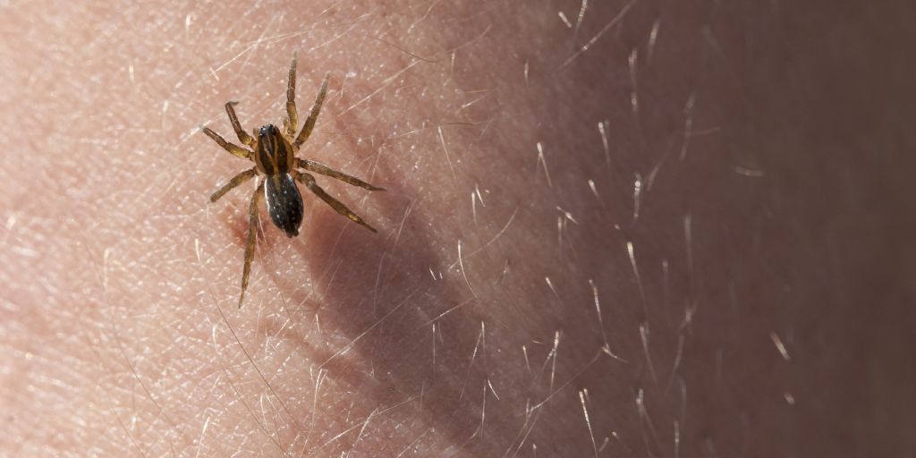 Spider bites - treatment, symptoms and first aid