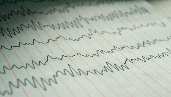 brain waves, eeg test