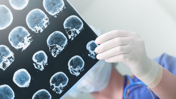 Medical experts studies EEG condition of a patient