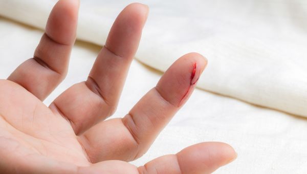 cut finger, injury