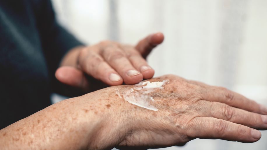 Senior applying skin cream to hand