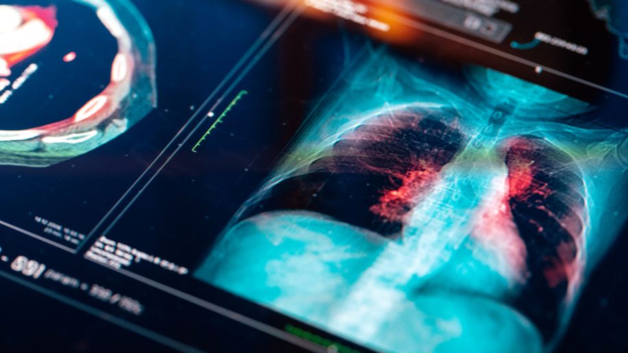 chest x-ray