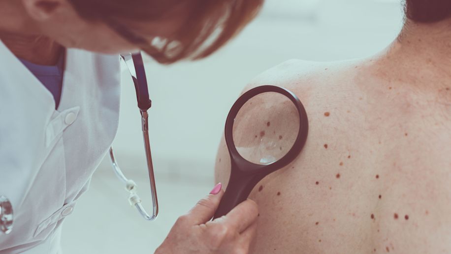 Dermatologist checks skin on patient.