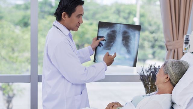 doctor showing patient lung x-ray