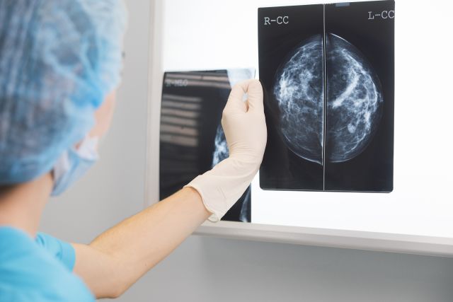 radiologist looking at mammogram imaging