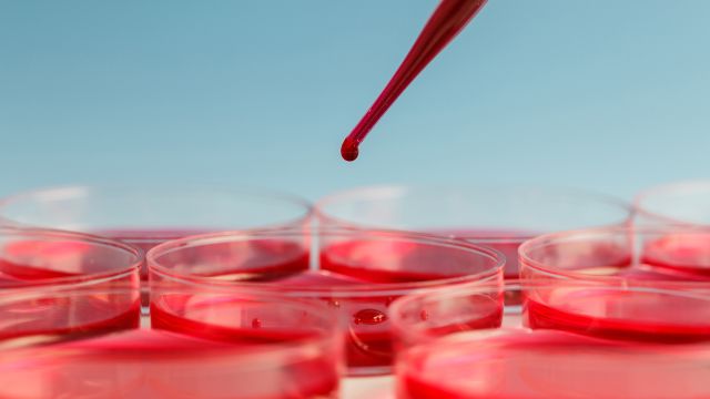 Blood samples are placed in petri dishes for testing.