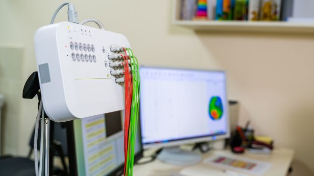 Neurologists have divided seizures into three major categories: focal onset seizures, generalized onset seizures and unknown onset seizures.