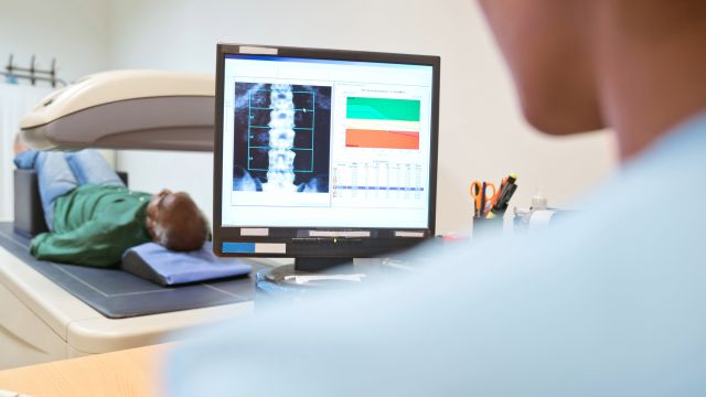 A technician views an x-ray image of the spinal column on a monitor during a bone density exam. 
