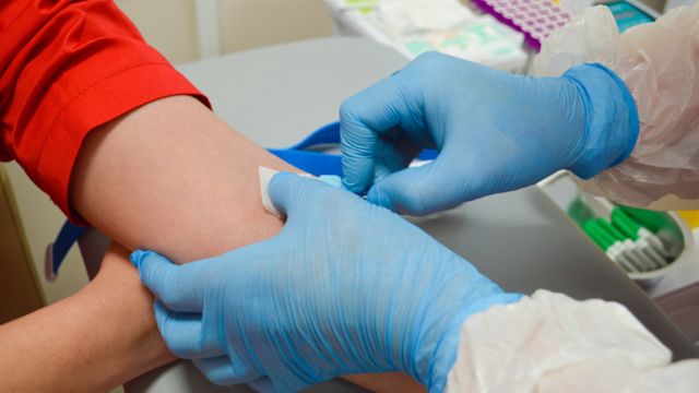 A healthcare provider draws a blood sample from a patient. Several blood tests can be used to confirm a diagnosis of HAE.