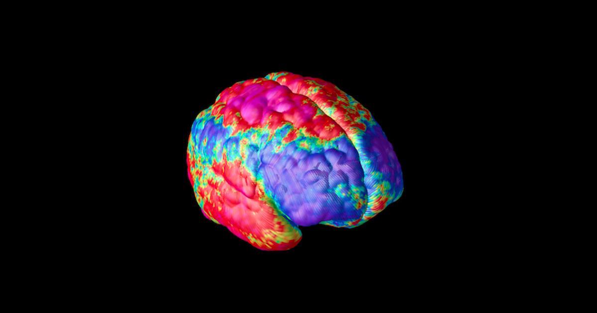 Mapping how schizophrenia changes brains | Pursuit by The University of ...